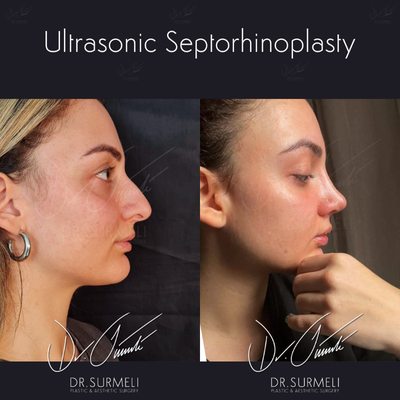 before and after image