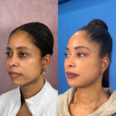 before and after image