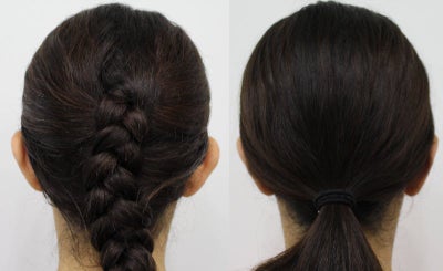 Ear Surgery before and after photo