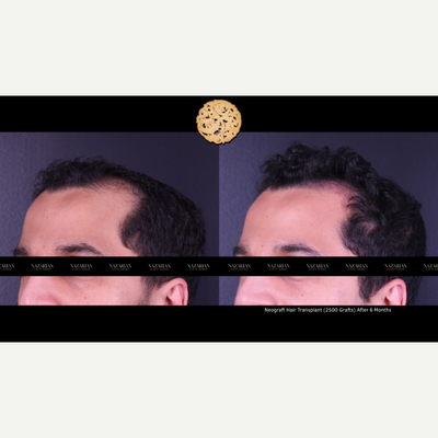 before and after image