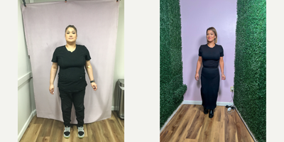 25-34 year old woman treated with Endoscopic Sleeve Gastroplasty - She lost 55 lbs with the Endoscopic Sleeve Gastroplasty procedure after 9 months