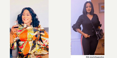 25-34 year old woman treated with Gastric Balloon - This beautiful patient came to us to lose weight, and was very happy with the result thanks to our gastric balloon treatment
