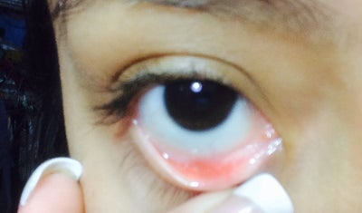 ice eye syte ice eye syte