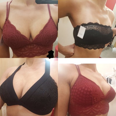 34F to 34C Breast Reduction - Atanu Biswas, MD - Review - RealSelf