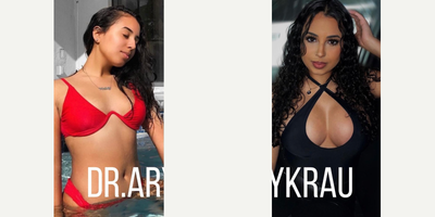 18-24 year old woman treated with Breast Augmentation - Im so happy with my results! Im going on 5 months post breast augmentation and I did 400cc high profile implants. Ive gotten so many compliments on them, Im so glad I chose you and your team!