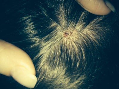 Do you know what this bump on my head could be? (photo) Doctor Answers ...