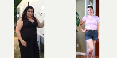 18-24 year old woman treated with Lap Band - 6 months post-op lost 102 lbs