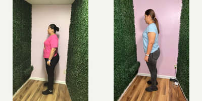 35-44 year old woman treated with Orbera Gastric Balloon, Gastric Balloon - She lost 60 LBS in 6 months after her Orbera Gastric Balloon weight loss procedure.