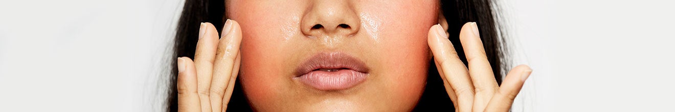 dr dennis gross rosacea