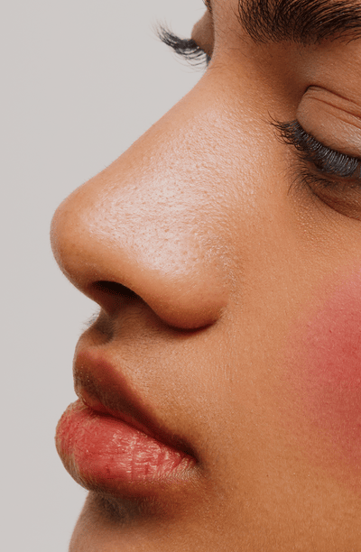 Rhinoplasty