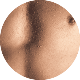 Chest