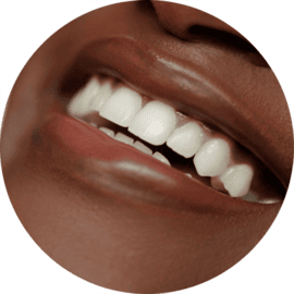 Teeth & Gums