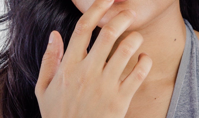 Dermal Fillers