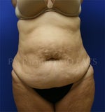 Top Semaglutide Providers in Smyrna, TN