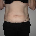 photo thumbnail image