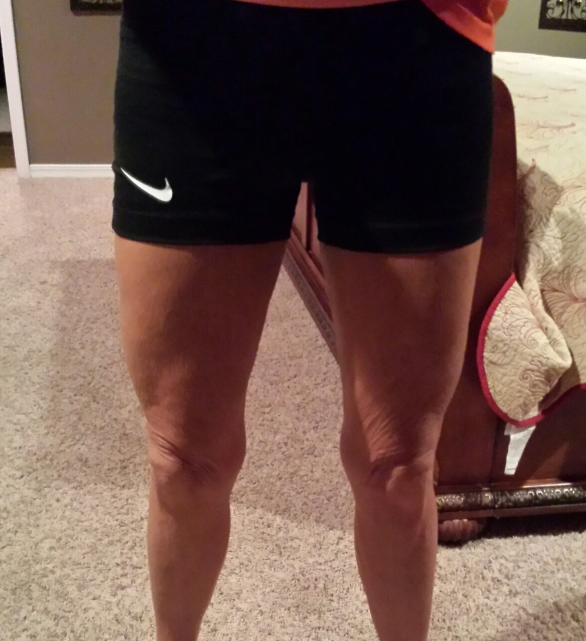 Mother of 3 (Set of Twins) LOST 110 Lbs with Diet and Exercise