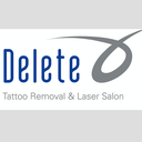 Delete Tattoo Removal and Laser Salon - Phoenix