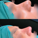 Amin Yousaf, MBBS, FCPS (Plast)