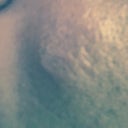 blured Injection gone wrong