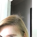 Hair Loss Extremely High Shbg Low Ferritin Ambien