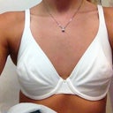 Removal HP 460cc Implants with Breast Lift - Review - RealSelf