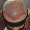 adamabreca