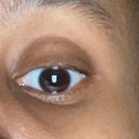 CANTHAL TILT POSITIVE NEUTRAL I I NEGATIVE I Outer eye corner is Outer and  inner eye Outer eye corer is above the innereye cormersareatsame below the  inner eye corner level comer 