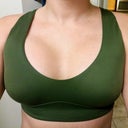 36F, 5'1, 415cc Sientra Mod+ - Review - RealSelf