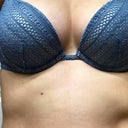 My 32DD plastic tits : r/plastic_girls
