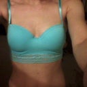 23 Y.o, 32F to 32D Breast Reduction - Review - RealSelf