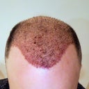 Mr Baldie