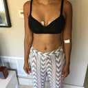 36 Years Old, 5'8, 145lbs, 1 Kid, 32C to Full 32F, 405cc Natrelle Smooth  Round Moderate Inspira Silicone Unders, Areola