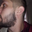 Minoxidil For Beard Growth How To Induce Terminalisation Of