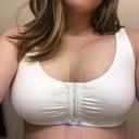 27, Married with No Kiddos, 5'3, 135 Lbs, 32G - Review - RealSelf